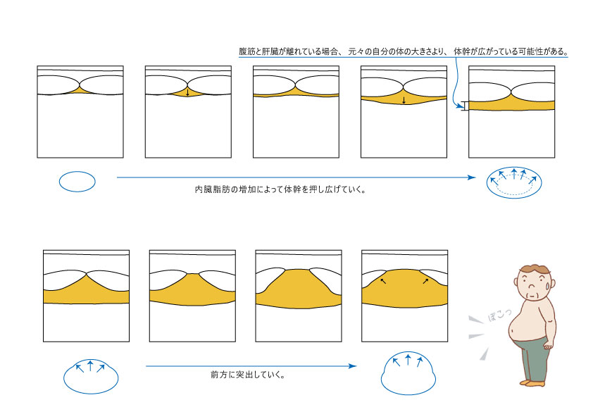 男性の内臓脂肪のつき方の図解。内臓脂肪の増加で体幹が押し広げられ、腹筋が硬いため前方に突出してぽっこりお腹になる