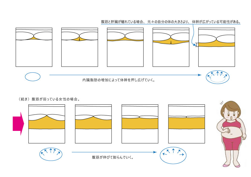 女性の内臓脂肪のつき方の図解。腹筋が伸びて内臓脂肪が均等に広がり、お腹全体が丸く膨らんでいく