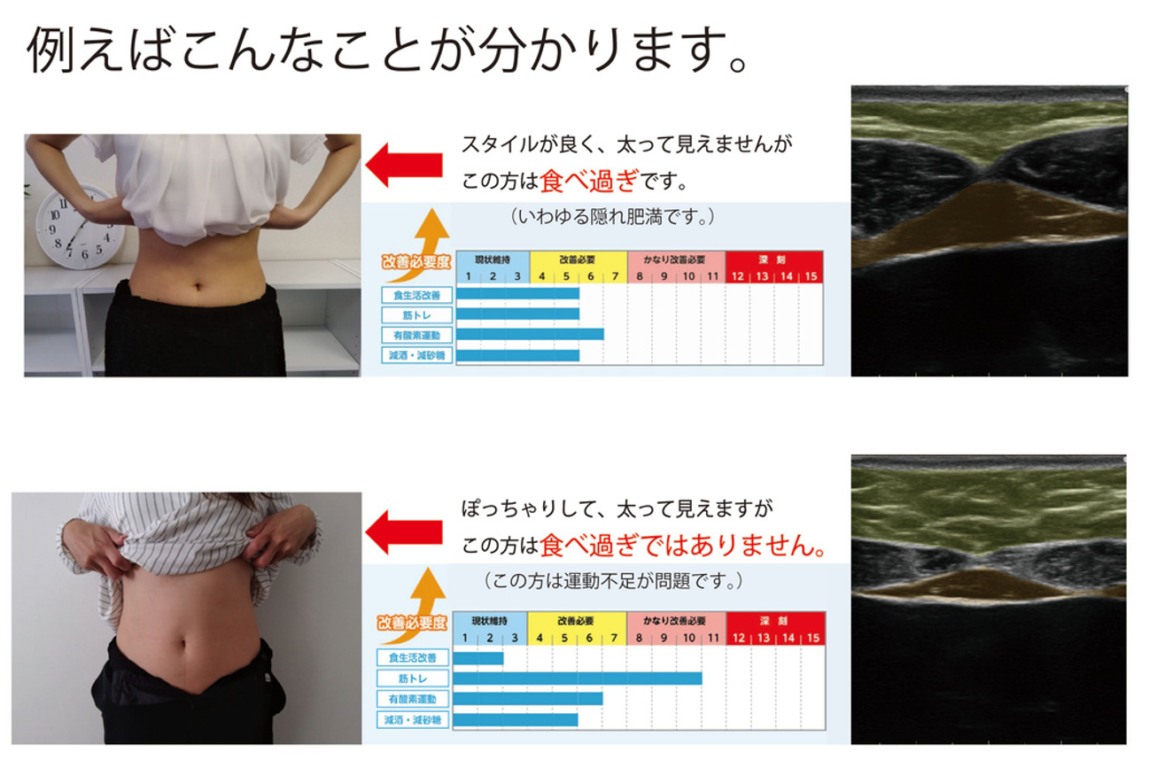 健康管理の可視化