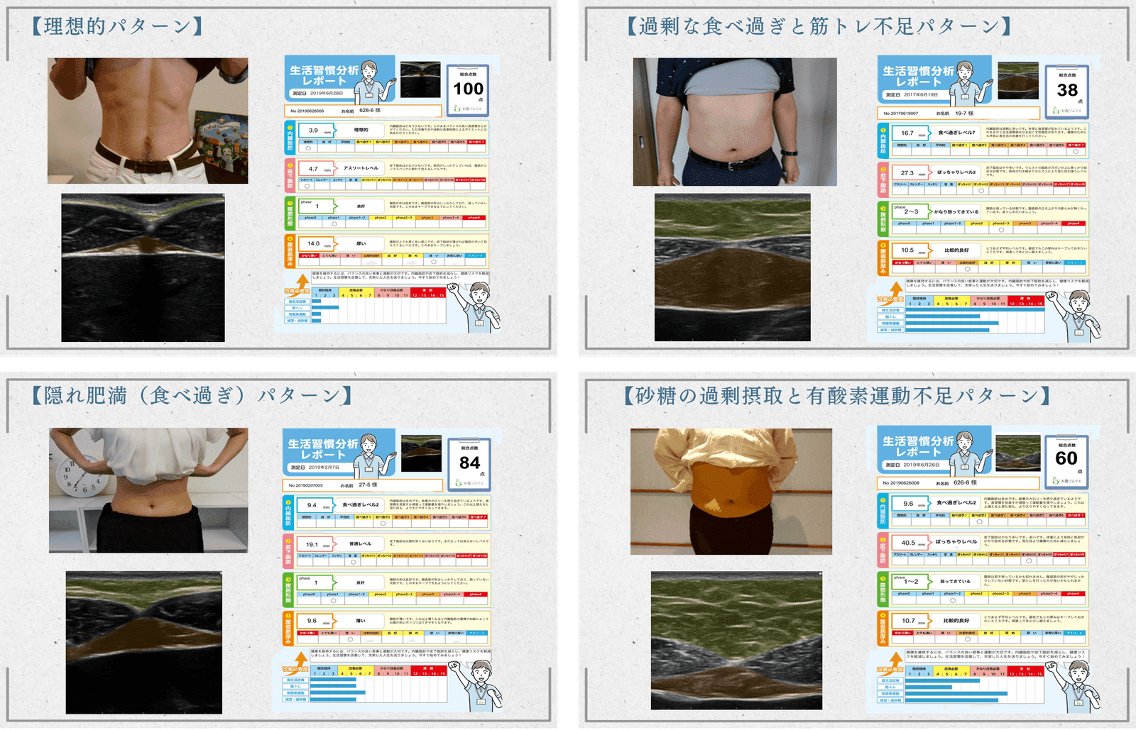 お腹のタイプ別の超音波画像とレポート例。理想的パターン、食べ過ぎ・筋トレ不足パターン、隠れ肥満パターン、砂糖の過剰摂取・有酸素運動不足パターンの4種を、実際のお腹の写真とエコー断面で比較