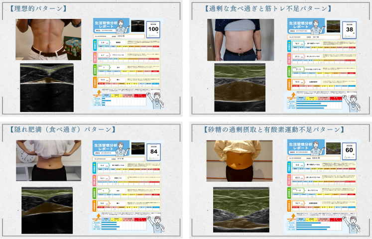 個別化されたアプローチ