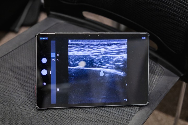 特許技術の利用権